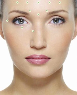 Инъекции ботокса